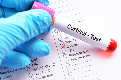 Kortisol – dit overlevelseshormon